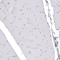 CDKL5 Antibody (CL4888) - Azide and BSA Free, Novus Biologicals 100 ul;