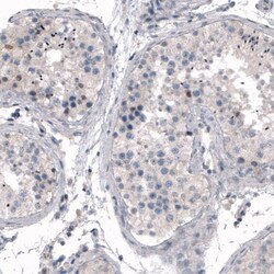 CDKL5 Antibody (CL4888) - Azide and BSA Free, Novus Biologicals 100 ul;