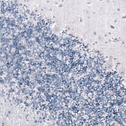 SMCHD1 Antibody (CL4265) - Azide and BSA Free, Novus Biologicals 100 ul;