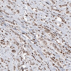 SMCHD1 Antibody (CL4265) - Azide and BSA Free, Novus Biologicals 100 ul;