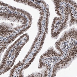 SMCHD1 Antibody (CL4265) - Azide and BSA Free, Novus Biologicals 100 ul;