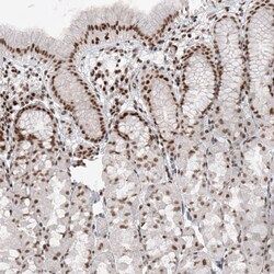 SMCHD1 Antibody (CL4265) - Azide and BSA Free, Novus Biologicals 100 ul;