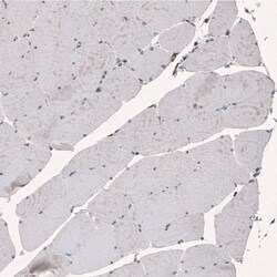 SMCHD1 Antibody (CL4270) - Azide and BSA Free, Novus Biologicals 100 ul;