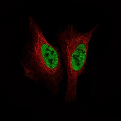 SMCHD1 Antibody (CL4270) - Azide and BSA Free, Novus Biologicals 100 ul;