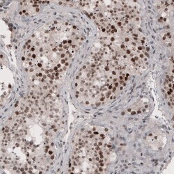 SMCHD1 Antibody (CL4270) - Azide and BSA Free, Novus Biologicals 100 ul;