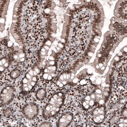 SMCHD1 Antibody (CL4270) - Azide and BSA Free, Novus Biologicals 100 ul;