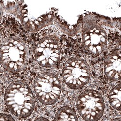 LAMP-1/CD107a Antibody (CL4490) - Azide and BSA Free, Novus Biologicals