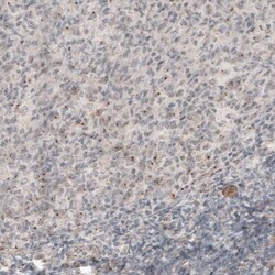 CDK5RAP2 Antibody (CL3392) - Azide and BSA Free, Novus Biologicals 100