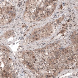 USP30 Antibody (CL4438) - Azide and BSA Free, Novus Biologicals 100 ul;