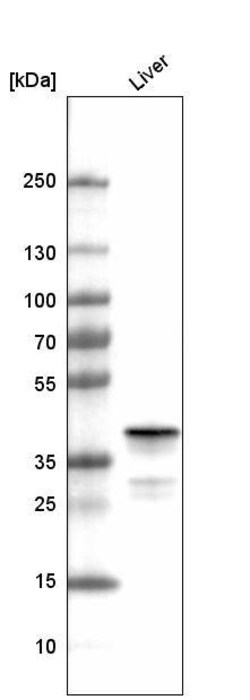 Ornithine Carbamoyltransferase Antibody (CL4045) - Azide and BSA Free,