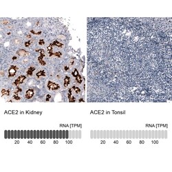 ACE-2 Antibody (CL4013) - Azide and BSA Free, Novus Biologicals 100 ul;