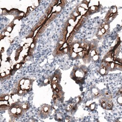 ACE-2 Antibody (CL4013) - Azide and BSA Free, Novus Biologicals 100 ul;