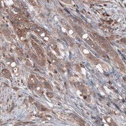 B-Raf Antibody (CL4004) - Azide and BSA Free, Novus Biologicals™