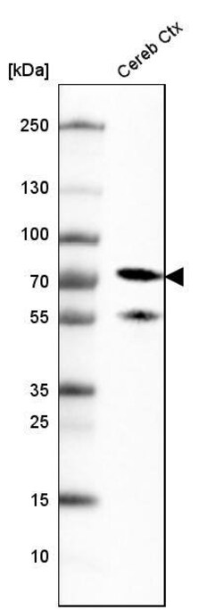 NF-L Antibody (CL4729) - Azide and BSA Free, Novus Biologicals 100 ul;