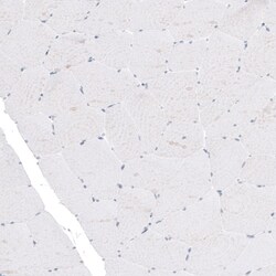 TYRP1 Antibody (CL4917) - Azide and BSA Free, Novus Biologicals 100 ul;