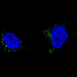 TYRP1 Antibody (CL4917) - Azide and BSA Free, Novus Biologicals 100 ul;