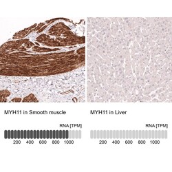 Myosin heavy chain 11 Antibody (CL14617) - Azide and BSA Free, Novus Biologicals