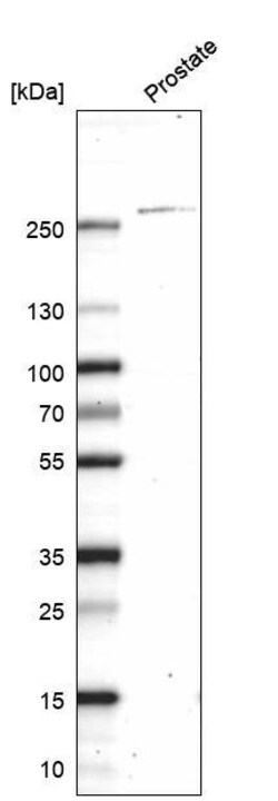 Myosin heavy chain 11 Antibody (CL14617) - Azide and BSA Free, Novus Biologicals