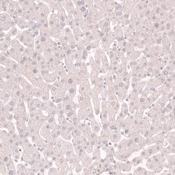 Myosin heavy chain 11 Antibody (CL14617) - Azide and BSA Free, Novus Biologicals