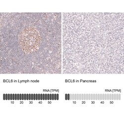 Bcl-6 Antibody (CL14612) - Azide and BSA Free, Novus Biologicals 100 ul;