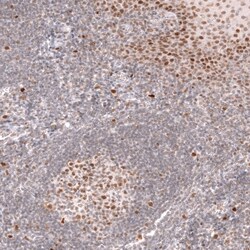 Bcl-6 Antibody (CL14612) - Azide and BSA Free, Novus Biologicals 100 ul;