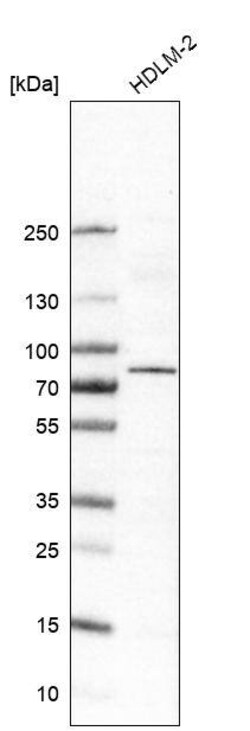 RIPK1/RIP1 Antibody (CL11357) - Azide and BSA Free, Novus Biologicals 100