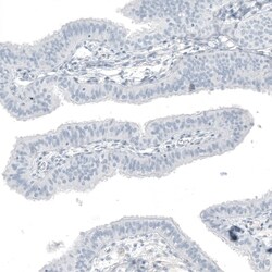 OTP Antibody (CL11222) - Azide and BSA Free, Novus Biologicals 100 ul;