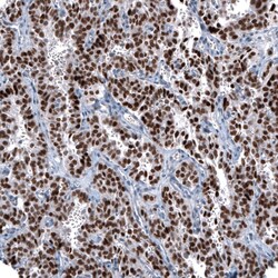 OTP Antibody (CL11222) - Azide and BSA Free, Novus Biologicals 100 ul;