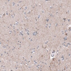 P2X7/P2RX7 Antibody (CL11508) - Azide and BSA Free, Novus Biologicals 100