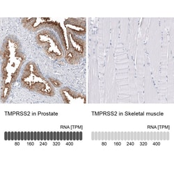 TMPRSS2 Antibody (CL12514) - Azide and BSA Free, Novus Biologicals 100