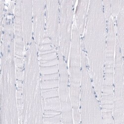 TMPRSS2 Antibody (CL12514) - Azide and BSA Free, Novus Biologicals 100