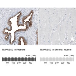 TMPRSS2 Antibody (CL12511) - Azide and BSA Free, Novus Biologicals 100