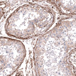 Integrin beta 1/CD29 Antibody (CL15622) - Azide and BSA Free, Novus Biologicals
