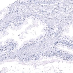 Calbindin D-28K Antibody (CL15059) - Azide and BSA Free, Novus Biologicals