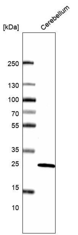 Calbindin D-28K Antibody (CL15059) - Azide and BSA Free, Novus Biologicals