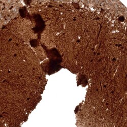 Parvalbumin Antibody (CL15072) - Azide and BSA Free, Novus Biologicals