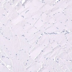 Parvalbumin Antibody (CL15072) - Azide and BSA Free, Novus Biologicals