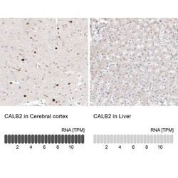 Calretinin Antibody (CL12842) - Azide and BSA Free, Novus Biologicals 100