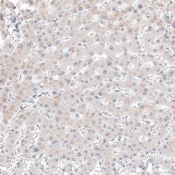 Calretinin Antibody (CL12842) - Azide and BSA Free, Novus Biologicals 100