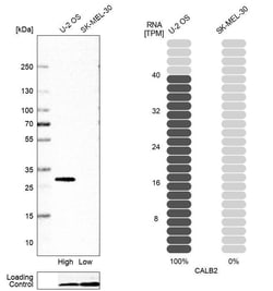 Calretinin Antibody (CL12842) - Azide and BSA Free, Novus Biologicals 100