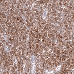 Calretinin Antibody (CL12842) - Azide and BSA Free, Novus Biologicals 100