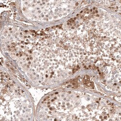 Calretinin Antibody (CL12836) - Azide and BSA Free, Novus Biologicals 100