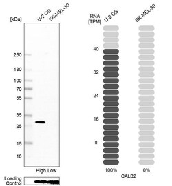 Calretinin Antibody (CL12836) - Azide and BSA Free, Novus Biologicals 100