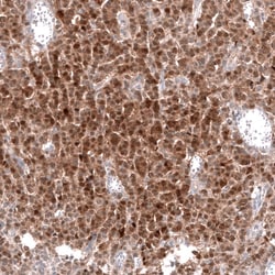 Calretinin Antibody (CL12836) - Azide and BSA Free, Novus Biologicals 100