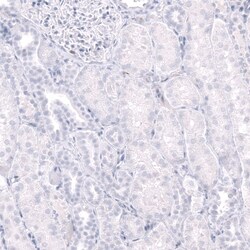 CD38 Antibody (CL15572) - Azide and BSA Free, Novus Biologicals 100 ul;