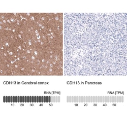 Cadherin-13 Antibody (CL15368) - Azide and BSA Free, Novus Biologicals