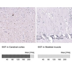 Somatostatin Antibody (CL15076) - Azide and BSA Free, Novus Biologicals