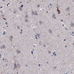 Nociceptin Antibody (CL15085) - Azide and BSA Free, Novus Biologicals 100