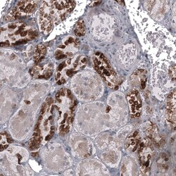 HE4/WFDC2 Antibody (CL12917) - Azide and BSA Free, Novus Biologicals 100