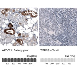 HE4/WFDC2 Antibody (CL12917) - Azide and BSA Free, Novus Biologicals 100